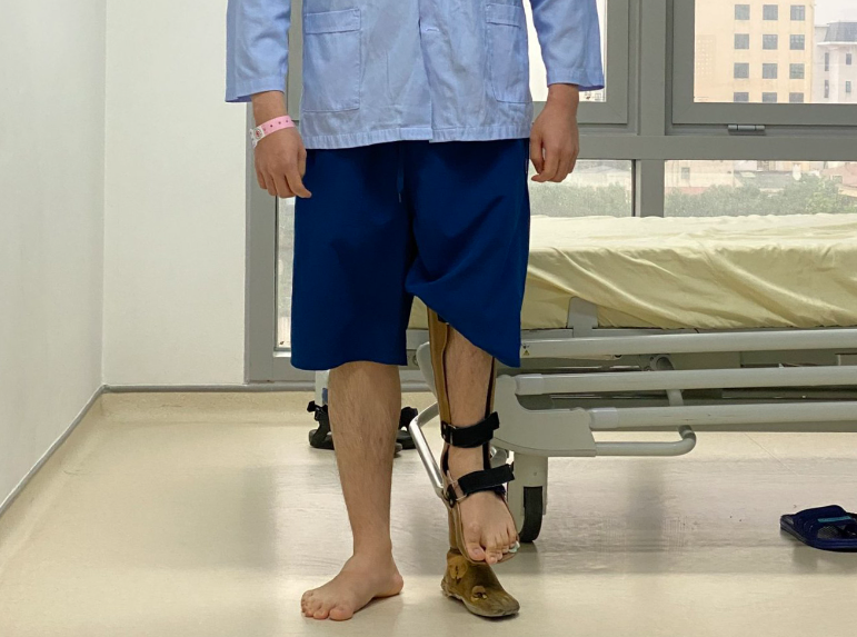 Người đàn ông 1.8m phẫu thuật kéo dài chân